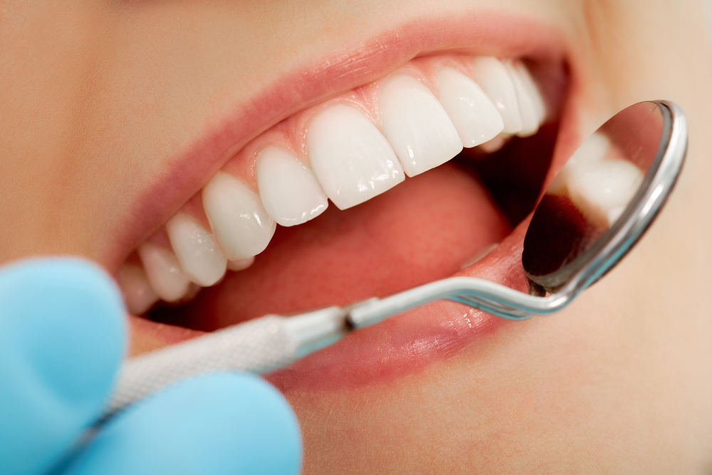 upclose photo of patient teeth with dental tool to show healthy teeth